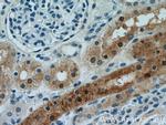 MUTYH Antibody in Immunohistochemistry (Paraffin) (IHC (P))