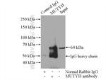 MUTYH Antibody in Immunoprecipitation (IP)