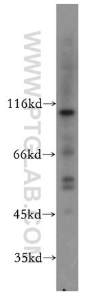 MUTYH Antibody in Western Blot (WB)