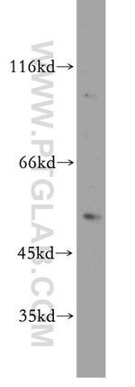 MUTYH Antibody in Western Blot (WB)