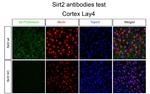 SIRT2 Antibody in Immunohistochemistry (IHC)