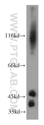 SIRT2 Antibody in Western Blot (WB)