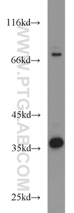 SIRT2 Antibody in Western Blot (WB)