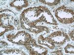 Hexokinase 1 Antibody in Immunohistochemistry (Paraffin) (IHC (P))