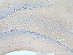 Hexokinase 1 Antibody in Immunohistochemistry (Paraffin) (IHC (P))