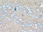 Hexokinase 1 Antibody in Immunohistochemistry (Paraffin) (IHC (P))