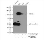 Hexokinase 1 Antibody in Immunoprecipitation (IP)