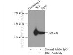 Hexokinase 1 Antibody in Immunoprecipitation (IP)