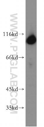 Hexokinase 1 Antibody in Western Blot (WB)