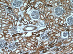 Hexokinase 1 Antibody in Immunohistochemistry (Paraffin) (IHC (P))