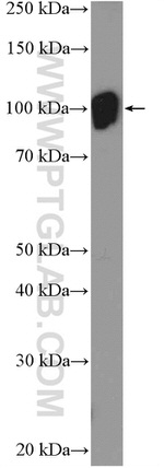 Hexokinase 1 Antibody in Western Blot (WB)