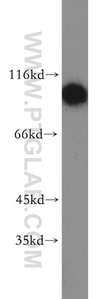 Hexokinase 1 Antibody in Western Blot (WB)