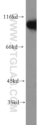 Hexokinase 1 Antibody in Western Blot (WB)