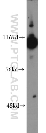 Hexokinase 1 Antibody in Western Blot (WB)