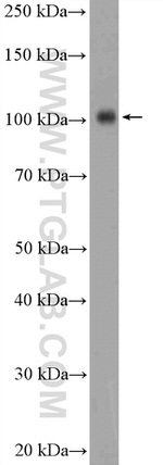 Hexokinase 1 Antibody in Western Blot (WB)