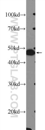 FOXL2 Antibody in Western Blot (WB)