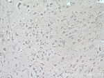 MYH10 Antibody in Immunohistochemistry (Paraffin) (IHC (P))