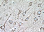 MYH10 Antibody in Immunohistochemistry (Paraffin) (IHC (P))