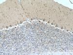 MYH10 Antibody in Immunohistochemistry (Paraffin) (IHC (P))