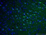 Caspase 3 Antibody in Immunohistochemistry (PFA fixed) (IHC (PFA))