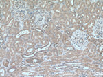 Caspase 3 Antibody in Immunohistochemistry (Paraffin) (IHC (P))