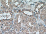 Caspase 3 Antibody in Immunohistochemistry (Paraffin) (IHC (P))