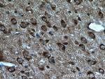 Caspase 3 Antibody in Immunohistochemistry (Paraffin) (IHC (P))