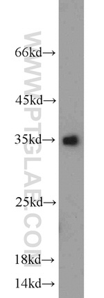 Caspase 3 Antibody in Western Blot (WB)