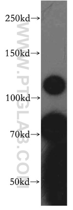 PMCA2 Antibody in Western Blot (WB)