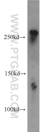 CACNA1B Antibody in Western Blot (WB)