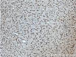 CACNA1B Antibody in Immunohistochemistry (Paraffin) (IHC (P))