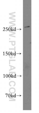 CACNA1B Antibody in Western Blot (WB)