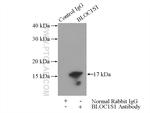 BLOC1S1 Antibody in Immunoprecipitation (IP)