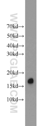 BLOC1S1 Antibody in Western Blot (WB)