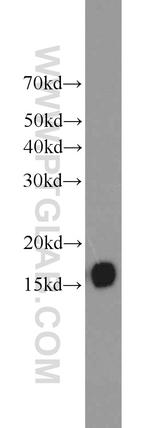 BLOC1S1 Antibody in Western Blot (WB)