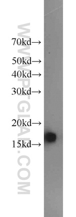 BLOC1S1 Antibody in Western Blot (WB)