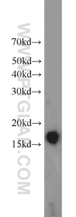 BLOC1S1 Antibody in Western Blot (WB)