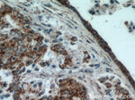 HIP1 Antibody in Immunohistochemistry (Paraffin) (IHC (P))