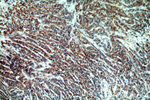 HIP1 Antibody in Immunohistochemistry (Paraffin) (IHC (P))