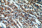 HIP1 Antibody in Immunohistochemistry (Paraffin) (IHC (P))