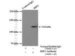 HIP1 Antibody in Immunoprecipitation (IP)