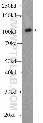 HIP1 Antibody in Western Blot (WB)