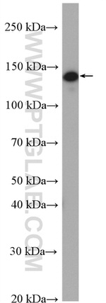 INPP5D Antibody in Western Blot (WB)