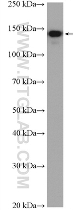 INPP5D Antibody in Western Blot (WB)