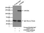 INPP5D Antibody in Immunoprecipitation (IP)