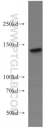 INPP5D Antibody in Western Blot (WB)