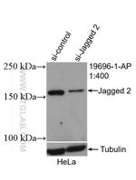 Jagged 2 Antibody in Western Blot (WB)