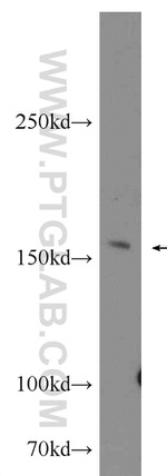 Jagged 2 Antibody in Western Blot (WB)