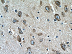 LIMK1 Antibody in Immunohistochemistry (Paraffin) (IHC (P))