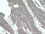 LIMK1 Antibody in Immunohistochemistry (Paraffin) (IHC (P))